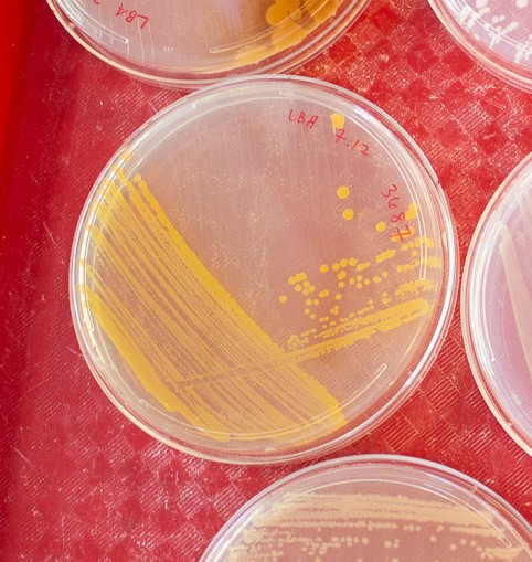 Example of streak plate using the three-way streaking method